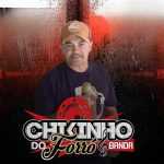 Playlists - Chikinho Do Forro Mais Tocadas Chikinho Do Forro mais tocadas 2026